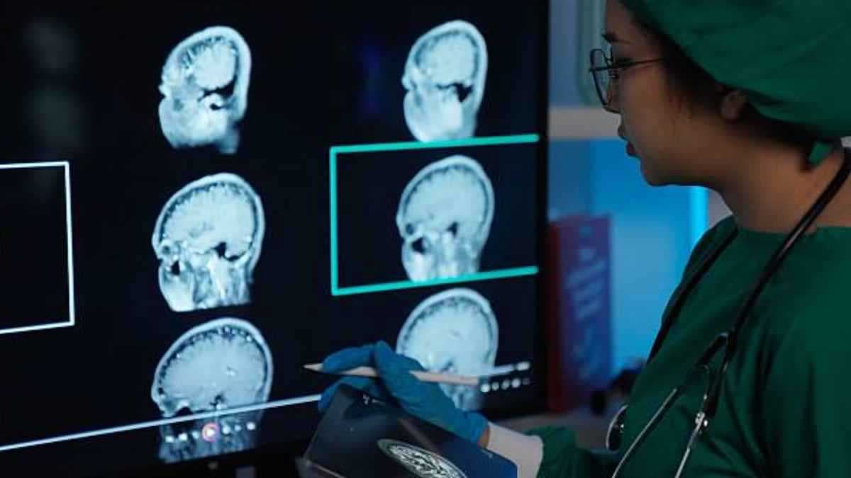 لماذا تختلف سرعة الشفاء الدماغي بين الرجال والنساء؟